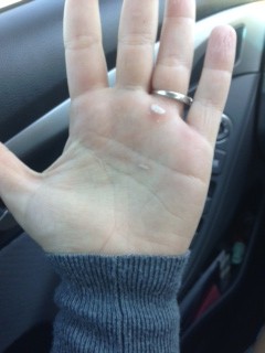 LOOK! I'm a real crossfitter now. I have the calluses to prove it!
